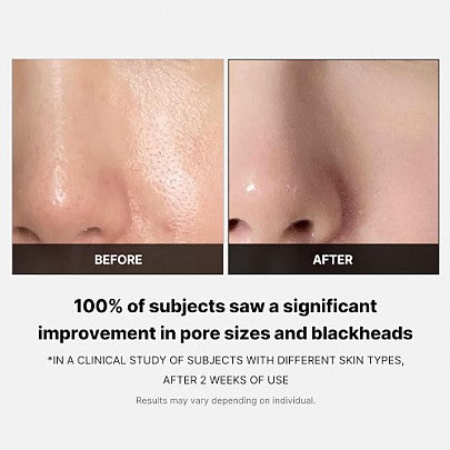 Medicube - Zero Pore Pad 2.0 (70 pads)
